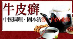 中药可以治疗牛皮癣吗？ 治疗效果怎么样？
