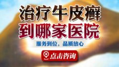 石家庄中医治疗银屑病哪家好?